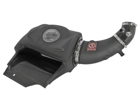 aFe Takeda Momentum Cold Air Intake System for Honda S2000 2000-2009 with Pro DRY S Filter